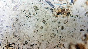 COCCIDIOZA (EIMERIOZA) PORUMBEILOR